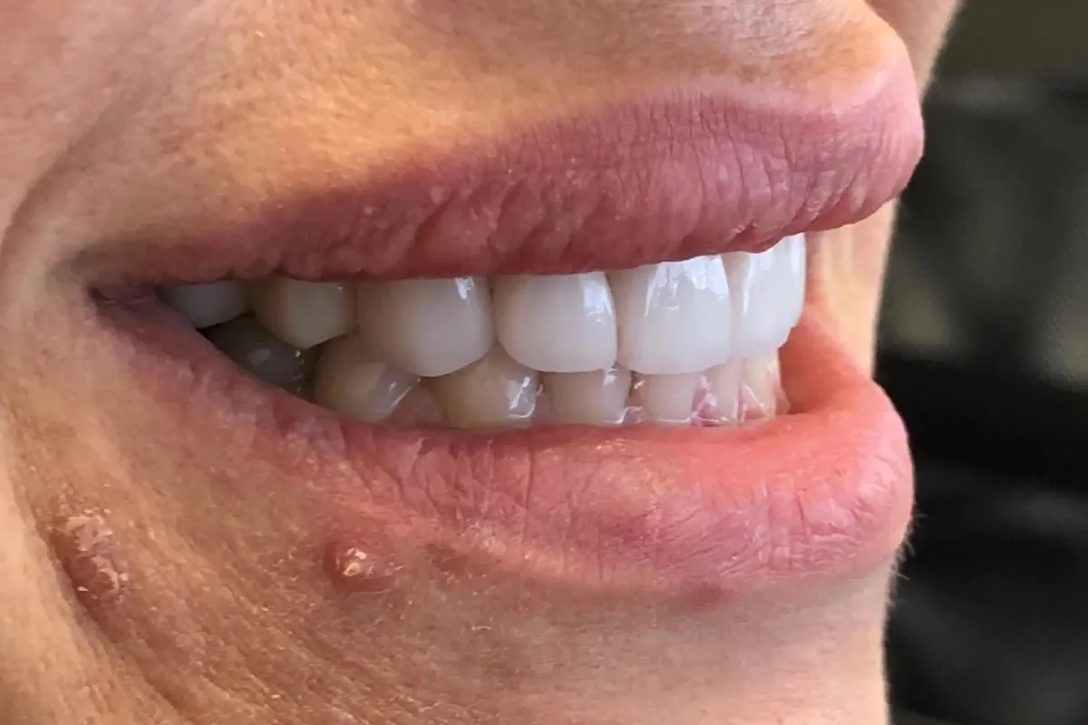 Smile Recreation Dentistry by Dr. Baseri — photo 4
