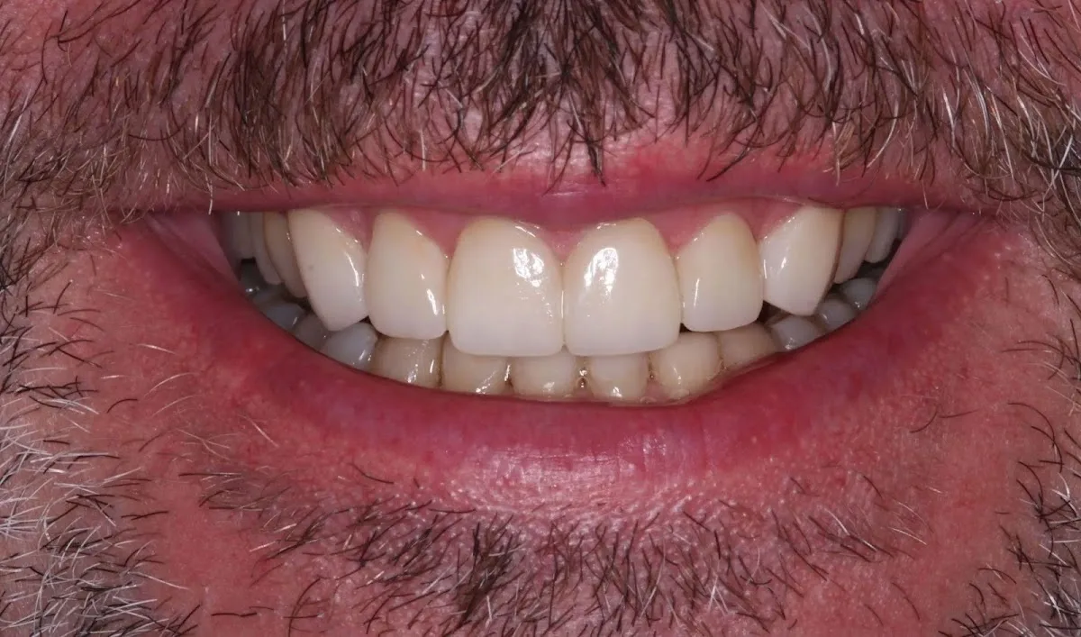 SmileCare Dental — photo 4