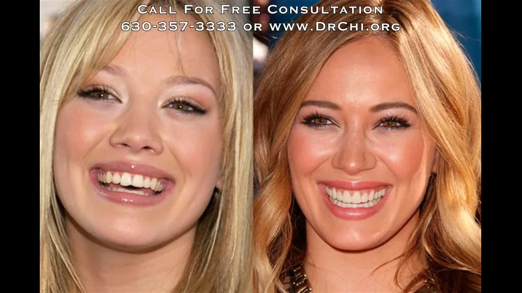 Smiles By Dr. Gibson Of Promenade Dental — photo 3