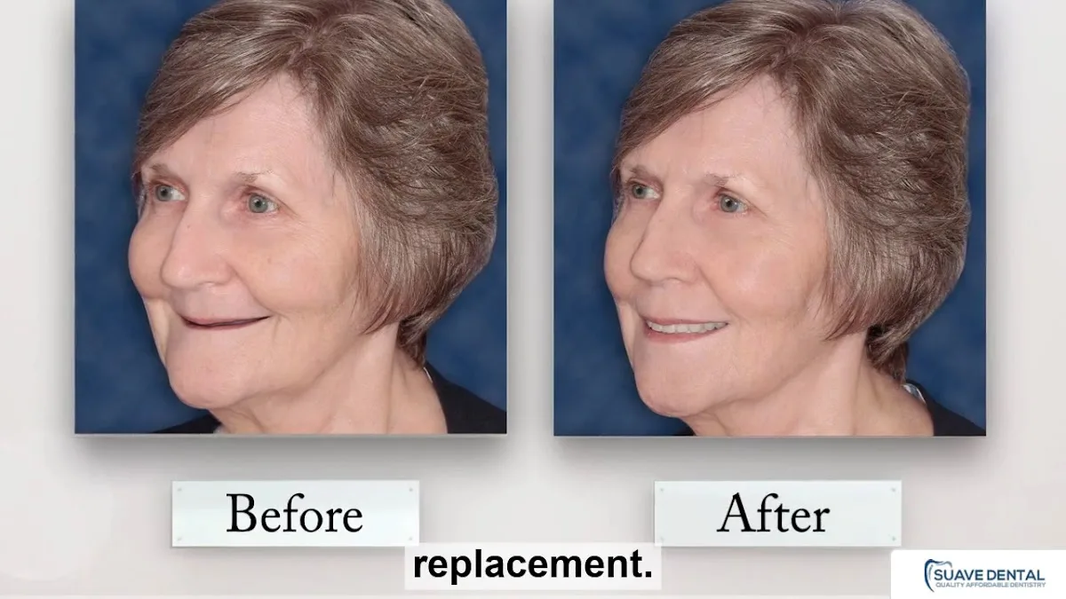 Suave Dental — photo 3