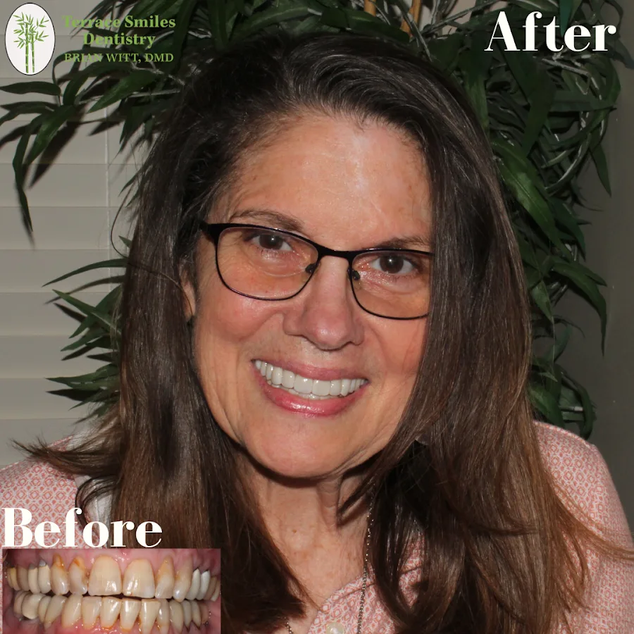 Tampa Dentist - Terrace Smiles Dentistry — photo 1