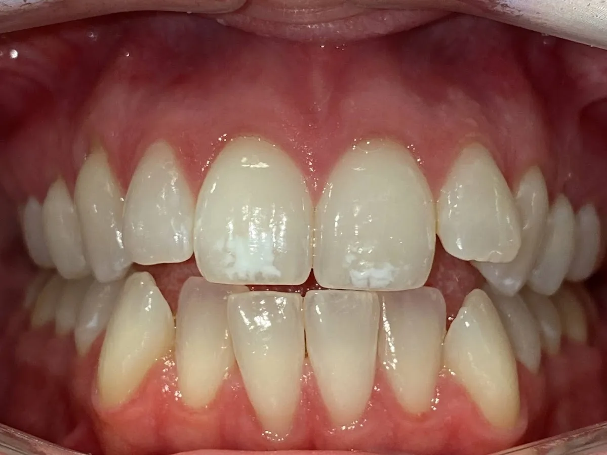 Team Dental - Northern Liberties