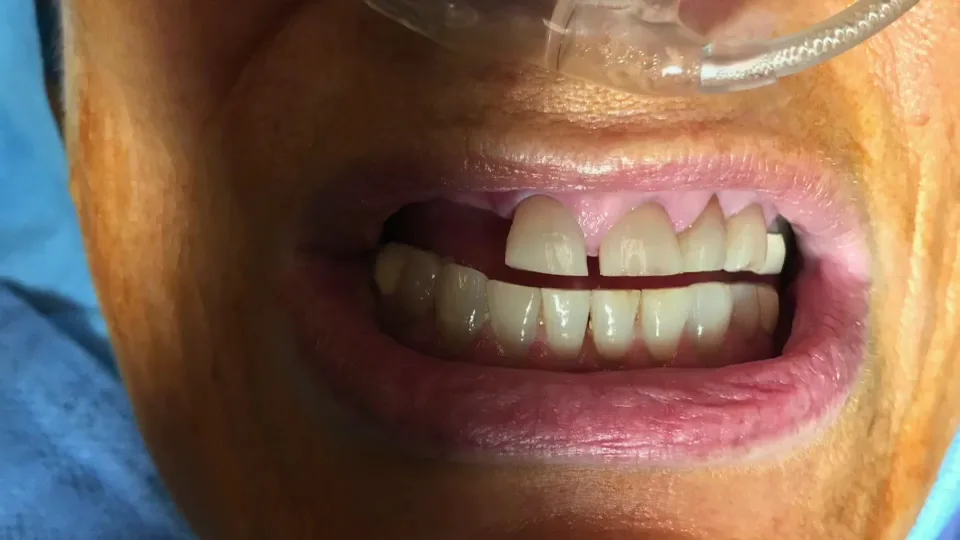 Texas Implant & Dental Center — photo 3