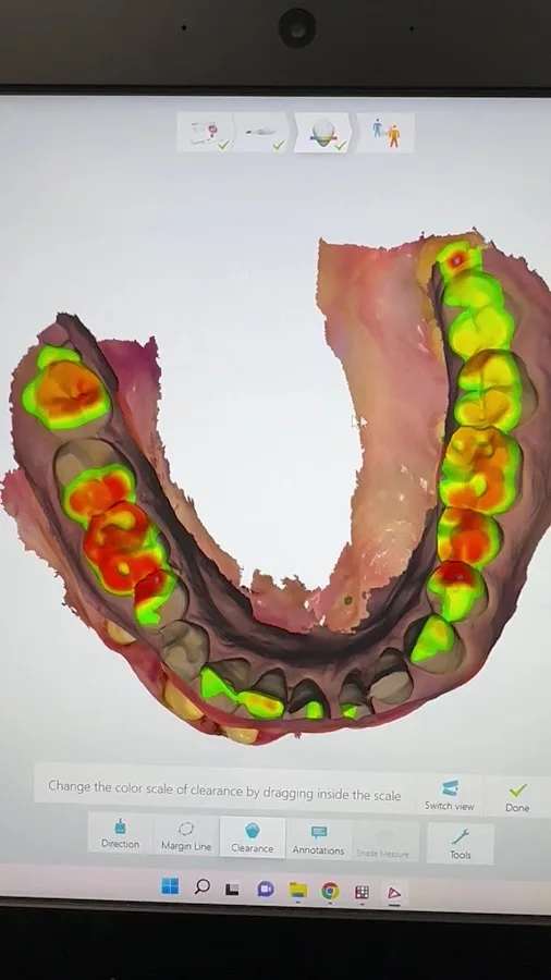 The Dental Method - Dentist of Dallas — photo 3