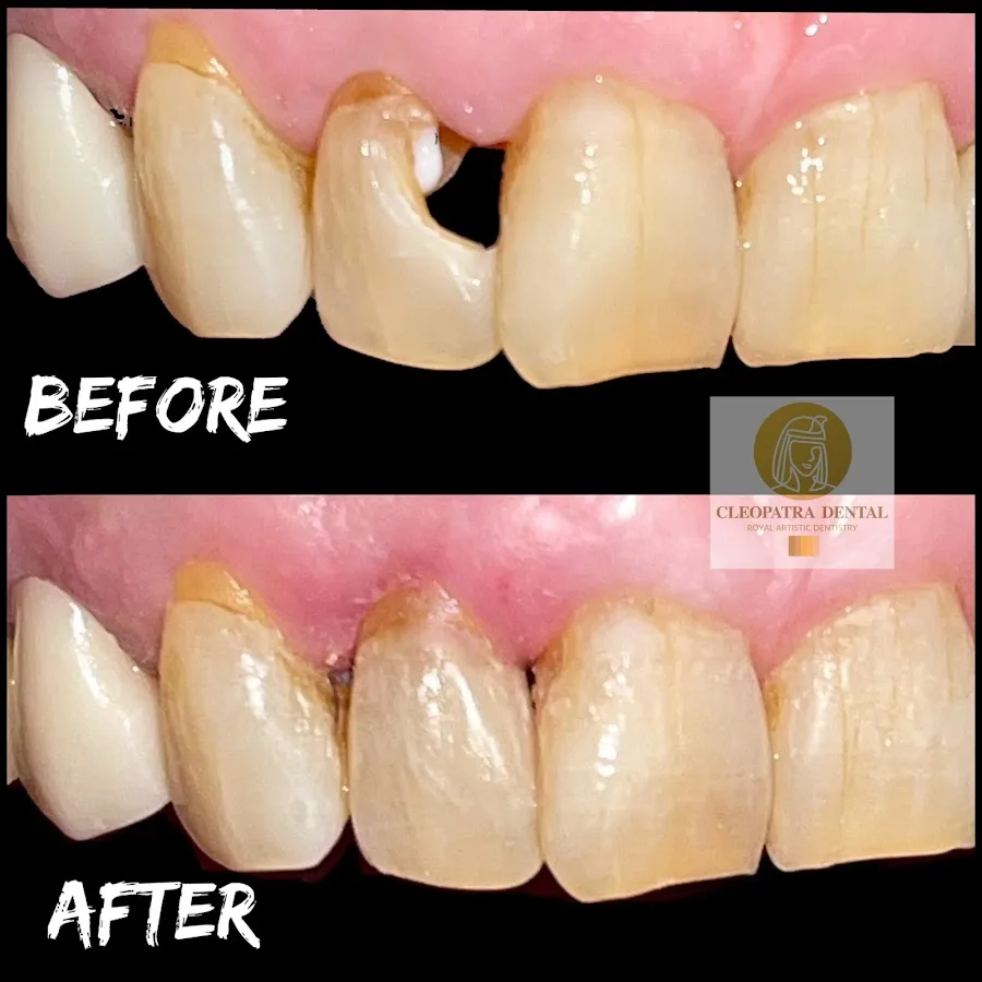 Tropic Dental Care | Cosmetic & Emergency Dentist Riverside — photo 5