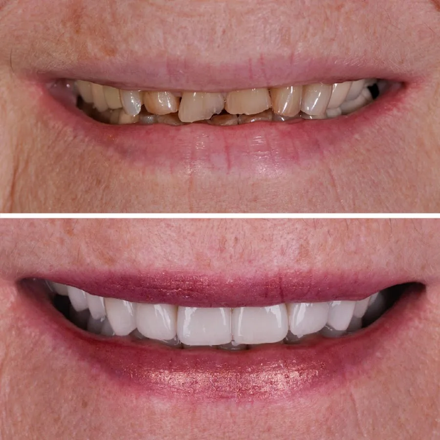 West Seattle Smile Co. — photo 2