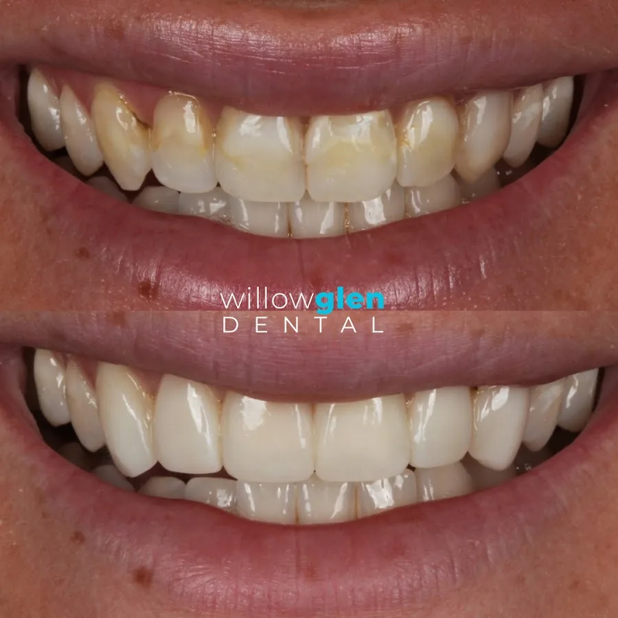 Willow Glen Dental — photo 2
