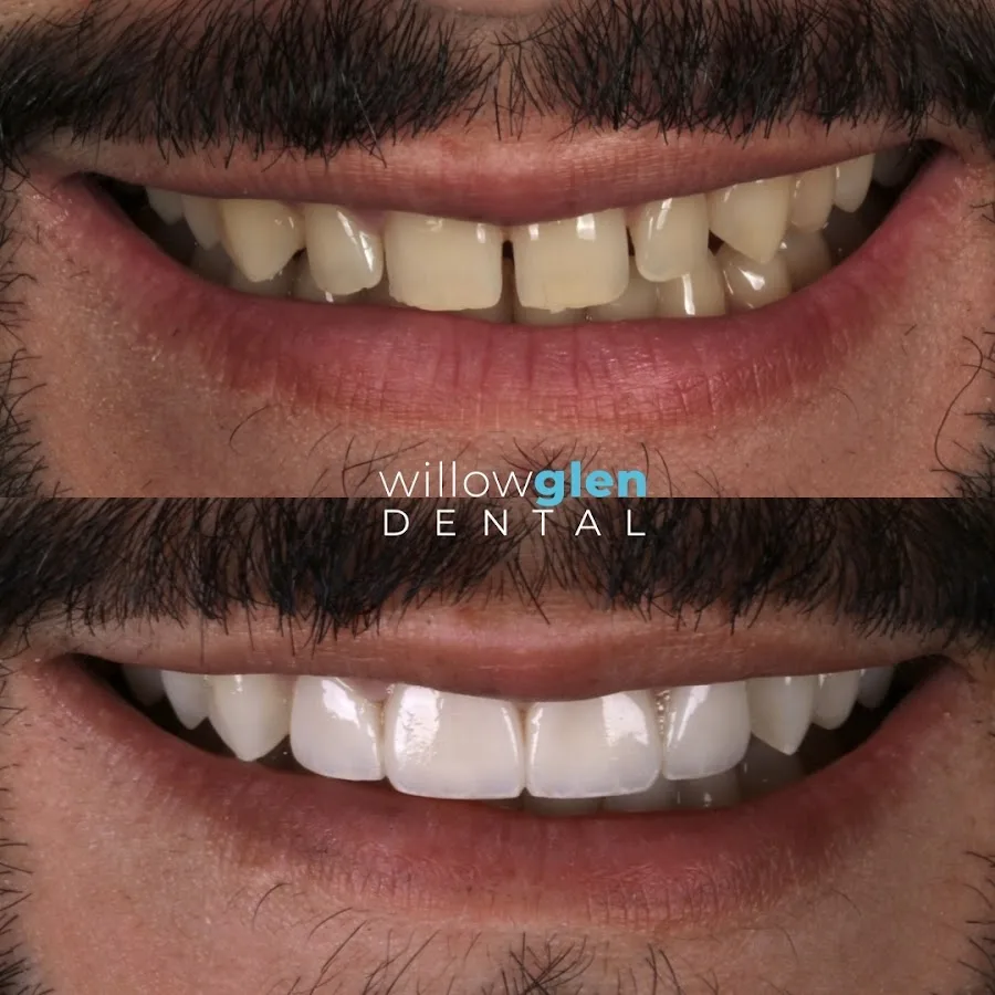 Willow Glen Dental — photo 3
