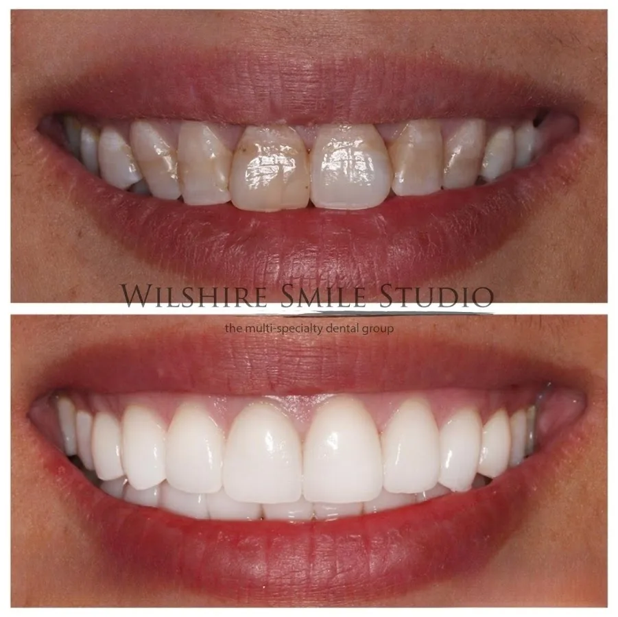 Wilshire Smile Studio - Los Angeles Dentist, Cosmetic and Emergency Dentistry — photo 4