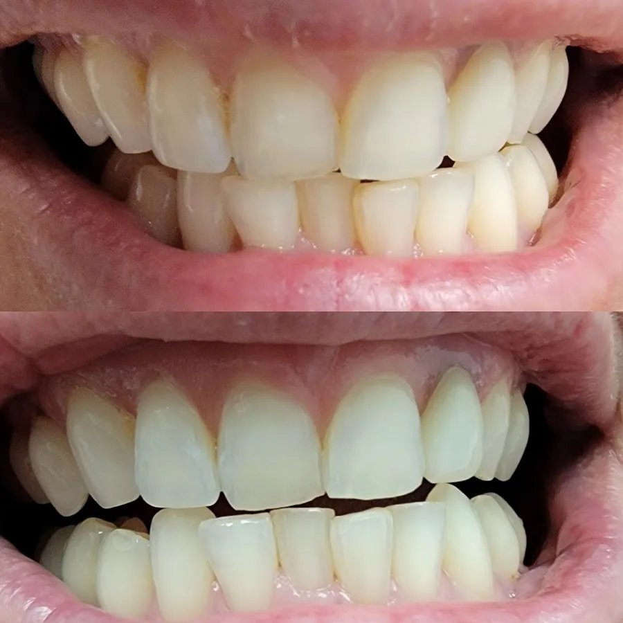 Winterholler Dentistry & Implant Surgery — photo 3