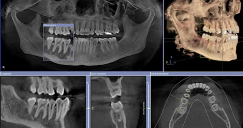 Your Desired Smile — photo 5