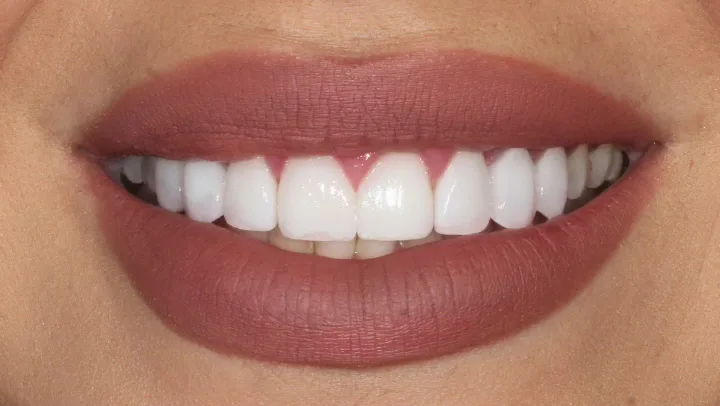 Zakhor Dental Group- Beverly Hills cosmetic dentist — photo 3