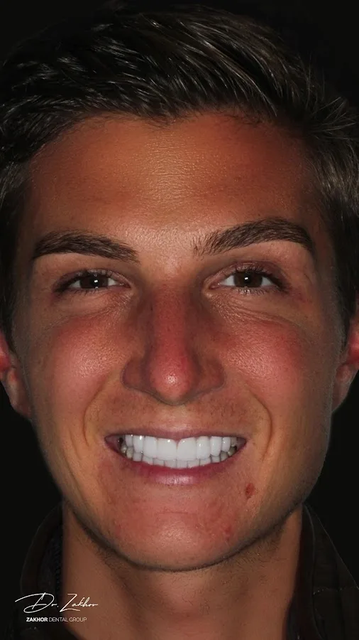 Zakhor Dental Group- Beverly Hills cosmetic dentist — photo 5