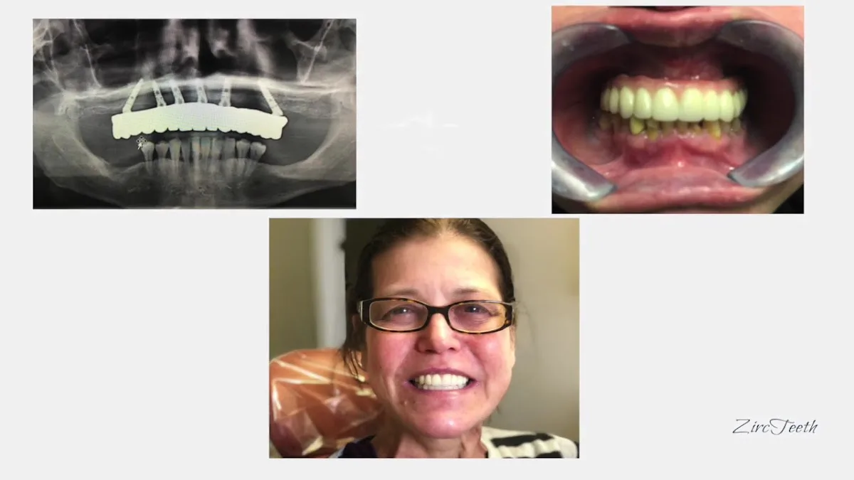 Zircteeth Of NH — photo 3